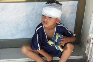 Injured-Palestinian-child